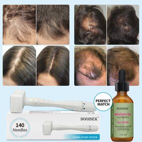 Derma Stamp Manufacturer - New Arrivals 140 Needle for Hair Beard Growth