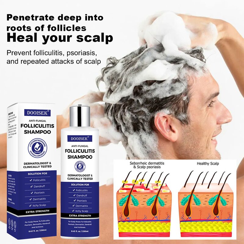 Anti Dandruff Shampoo Manufacturer - Direct Sales 250ml with Selenium Sulfide