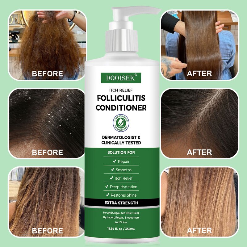 Antifungal Shampoo Manufacturer - Customize with Salicylic Acid & Tea Tree Oil