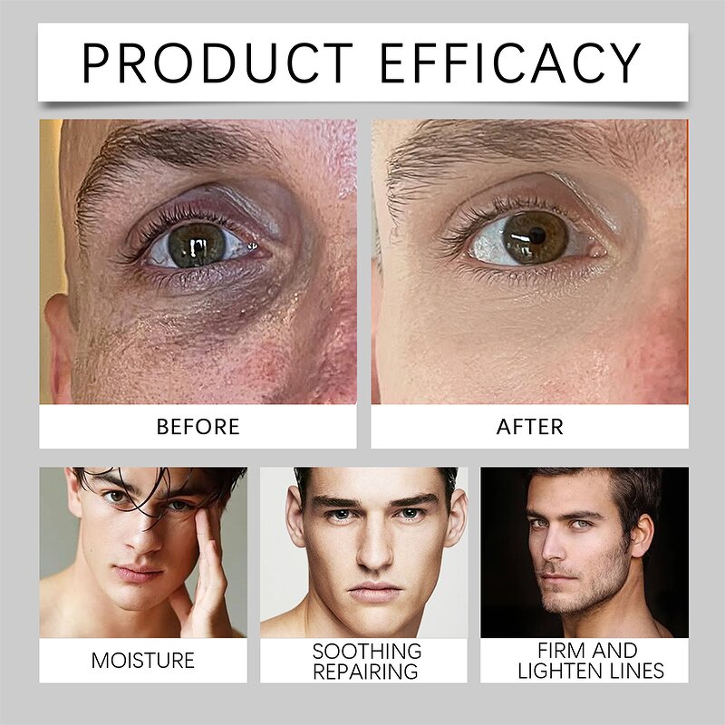 Eye Gel Pads - Manufacturer - Vegan Custom Hyaluronic Vitamin C Caffeine Whitening Anti-Puffiness Dark Circles