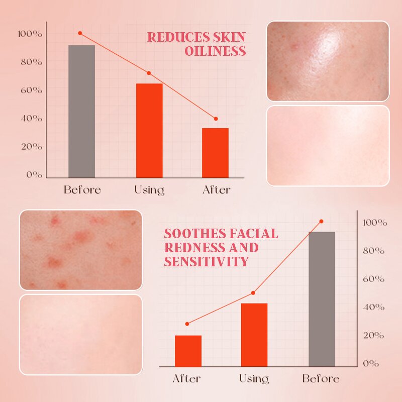 Korean Cleansing Mousse - Factory - Lactic Acid Niacinamide Amino Acid Sulfate-free Oil-Control Hydrating Cleanser