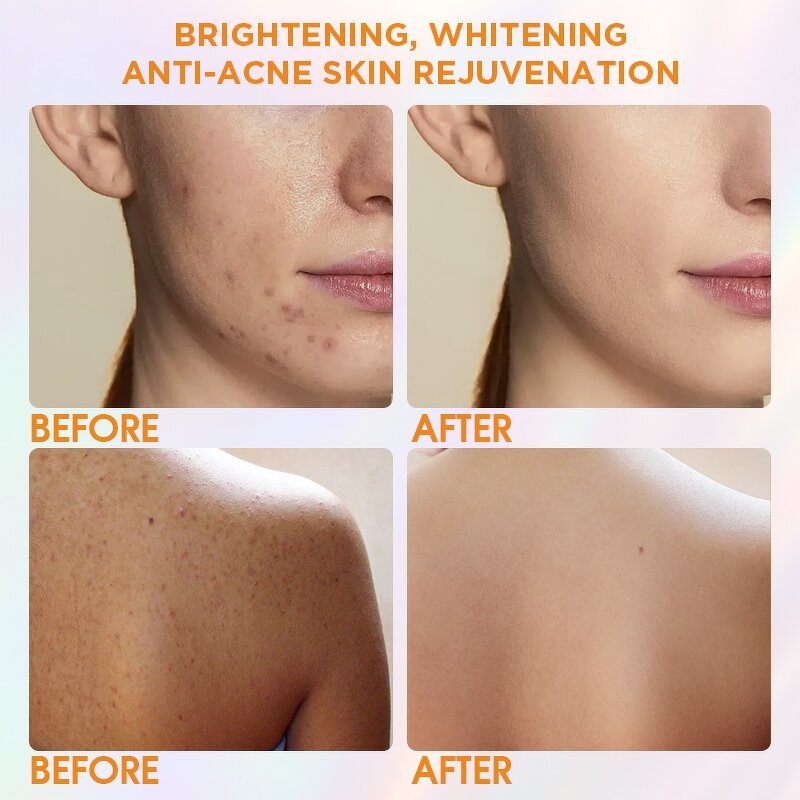 Beauty Soap - Factory - Private Label Vitamin C Kojic Glutathione Cruelty-free Whitening Anti Acne Soap