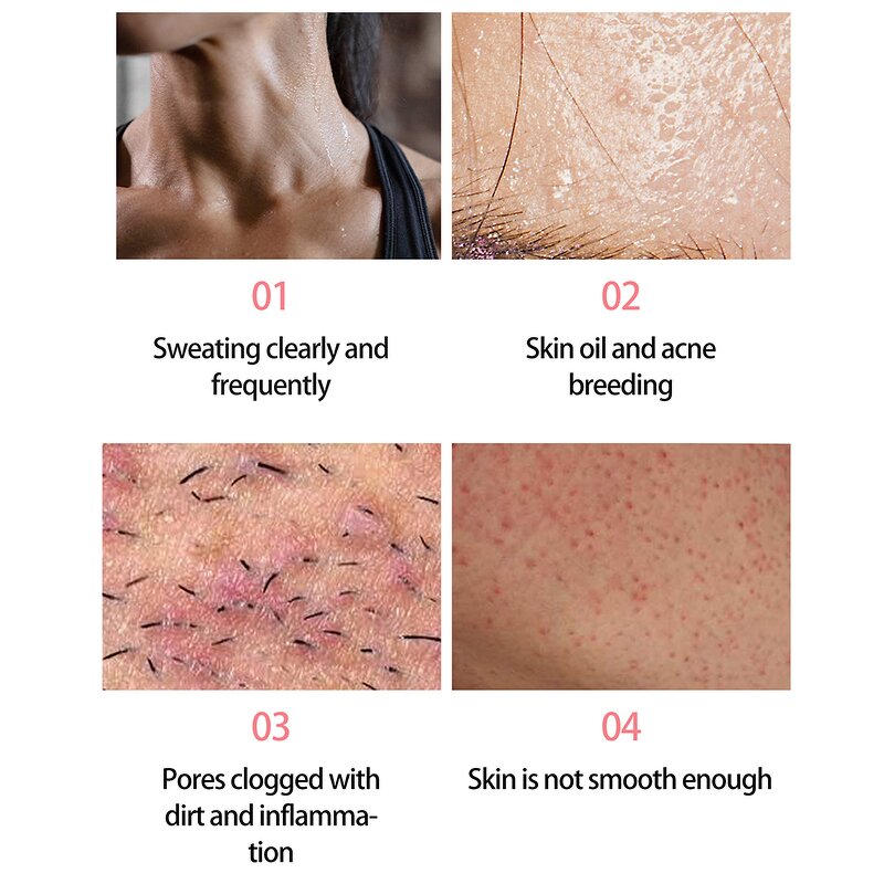 Bar Soap - Factory - Private Label Vitamin C Cedar Organic Herbal Sulfate-Free Vegan Oily Skin Brighten Moisturize