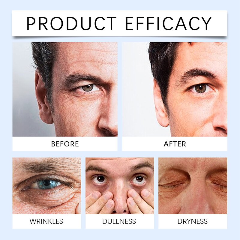 Men Eye Cream - Factory - Vitamin E Hyaluronic Acid Brightening Firming Reduce Dark Circles Eye Treatment