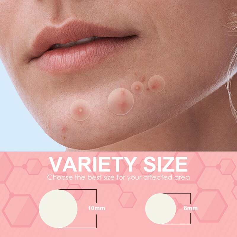 Acne Pimple Patch Manufacturer - Face Acne Dark Spot Skin Care Products & Private Label Hot Sale