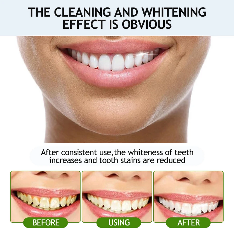 Toothpaste Manufacturer - Anti Sensitivity Activated Charcoal Whitening Bulk Private Label