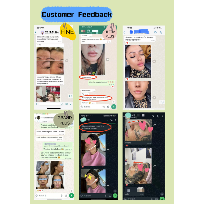 Dermal Filler Manufacturer - SLENDERLANE 1ml Medical Facial Injection & Private Label