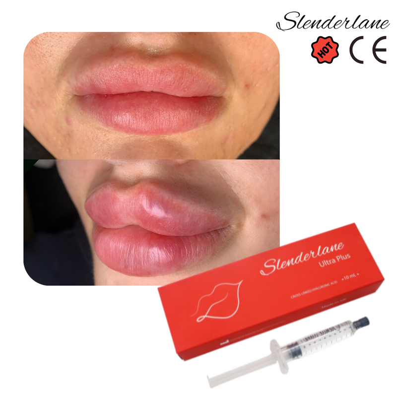 Dermal Filler Manufacturer - SLENDERLANE Korea HA Lip Derm 1/10ml Enlargement