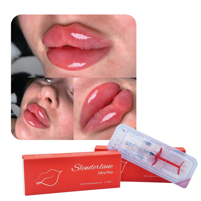 Dermal Filler Manufacturer - Cross Linked HA Gel Wrinkles Lip 1/2/10ml Derm Deep