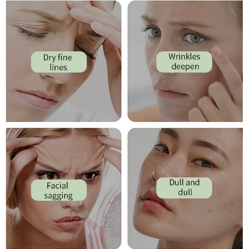 Anti-Acne Cream Manufacturer - Premium Moisturizing Calming Repair Problem Skin Relief Lotion