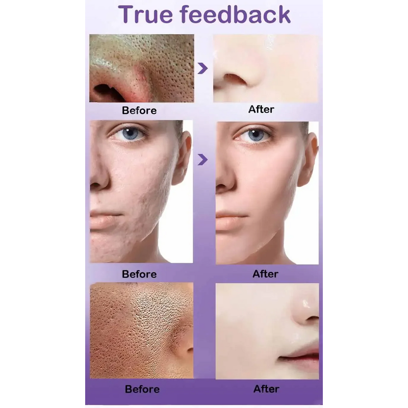 Skin Care Set Manufacturer - Korean Anti-Aging Retinol Serum Wrinkle Remover Firming Camellia