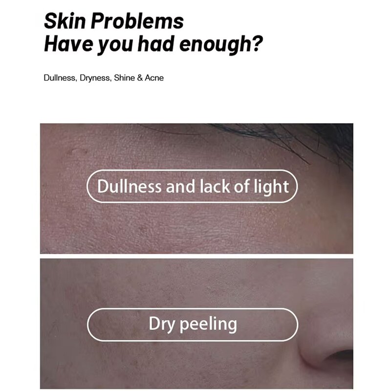 Body Lotion Manufacturer - Vitamin E Hyaluronic Acid Nourishing Sun Protector All Skin Types