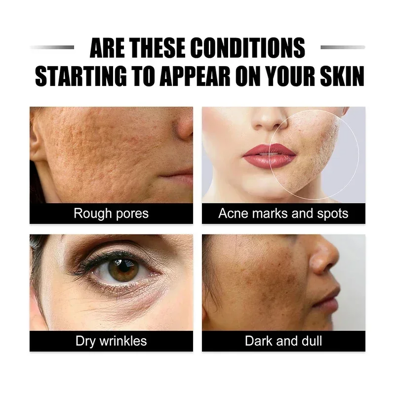 Dark Spot Remover Cream Manufacturer - 30g Anti-Freckle Anti-Melasma Brightening Deep Hydration