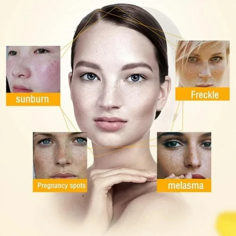 Face Cream Manufacturer - Anti-Pollution Whitening Brightens Dark Spots Hyperpigmentation Age Spots