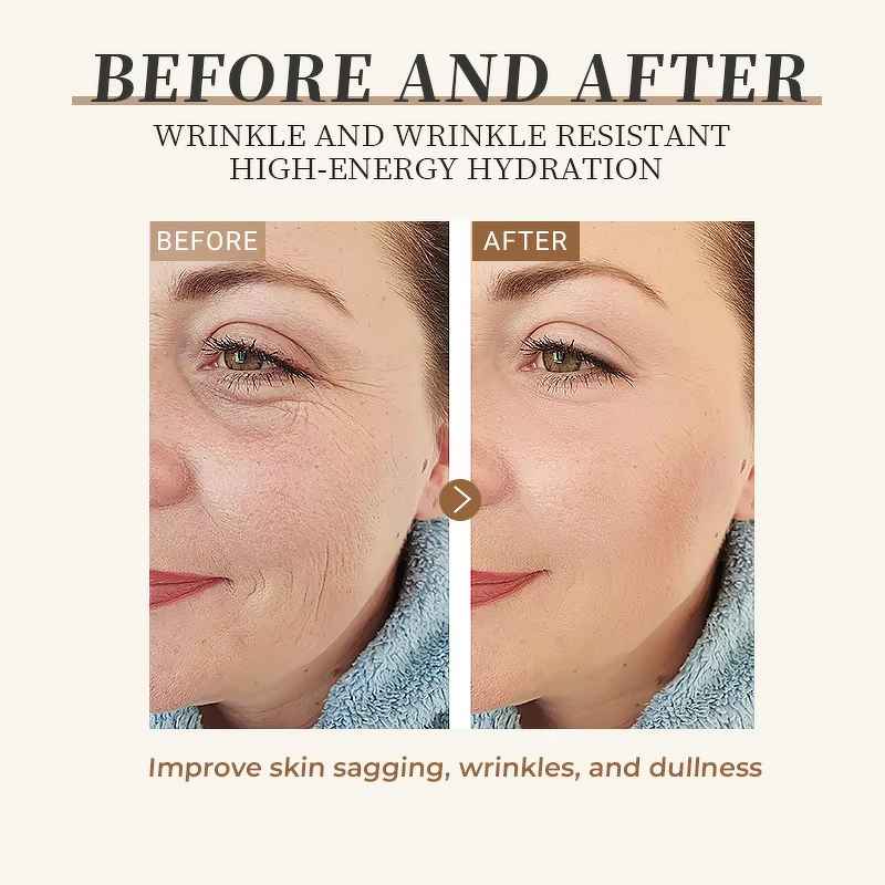 Anti-Acne Cream Manufacturer - Premium Moisturizing Calming Repair Problem Skin Relief Lotion