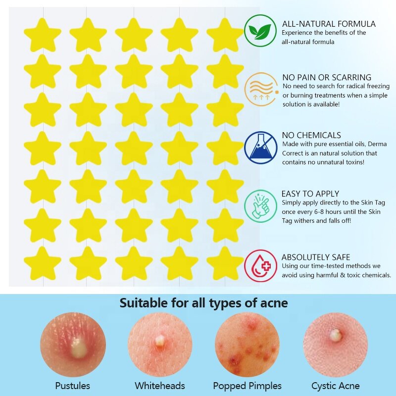 Acne Patch Manufacturer - Customized 35-Dot Hydrocolloid with Tea Tree Acid Oil