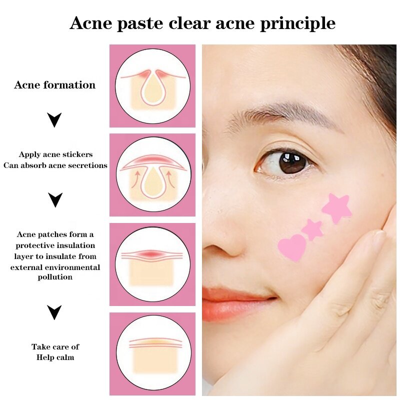 Pimple Patches Manufacturer - Private Label Cute Cartoon Hydrocolloid 36-Piece for Acne