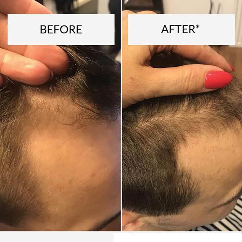 Hair Regrowth Mousse Manufacturer - Wholesale Private Label Natural Foam with Rice Water Biotin