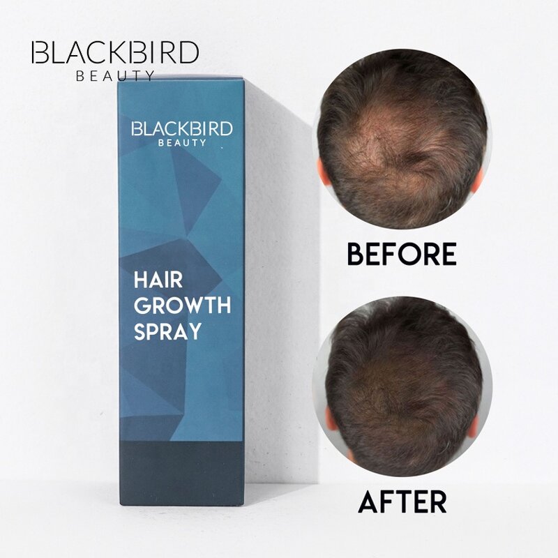Hair Growth Foam Manufacturer - Private Label Treatment for Hair Regrowth & Thinning