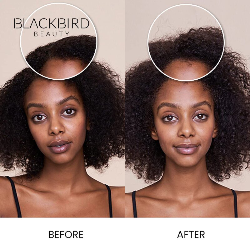 Scalp Exfoliating Scrub Manufacturer - Private Label Natural Anti Dandruff Charcoal Wholesale