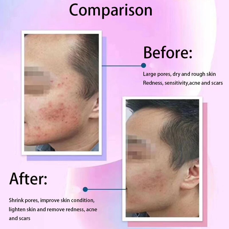 Facial Mask Manufacturer - Repairing Boosting Skin Refine Wrinkles Recombinant Collagen