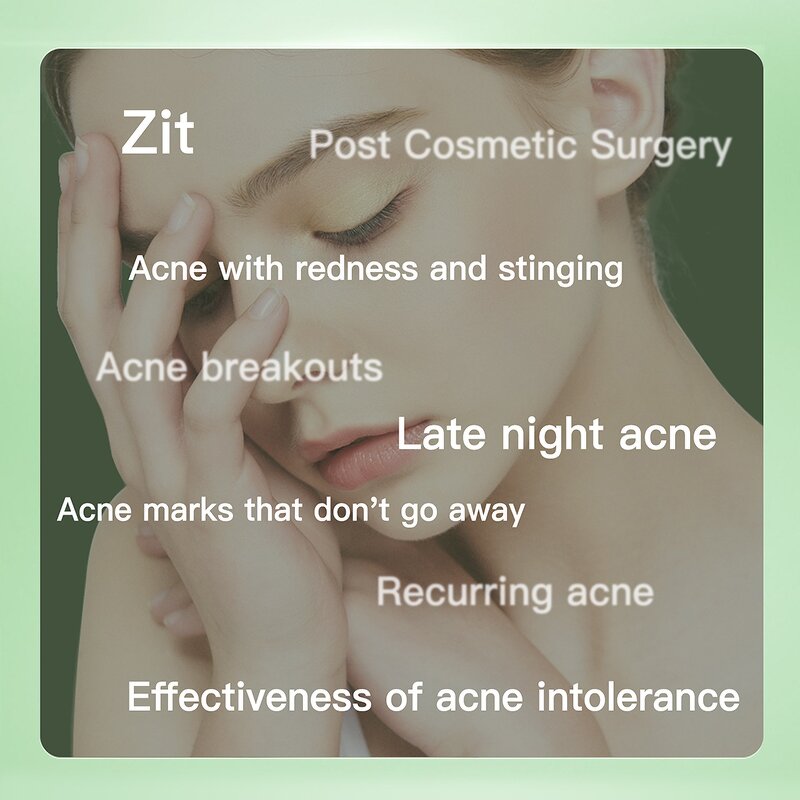 Face Sheet Mask Manufacturer - Anti Acne Pigmentation Removal Moisturizing Repair Hyaluronic Acid