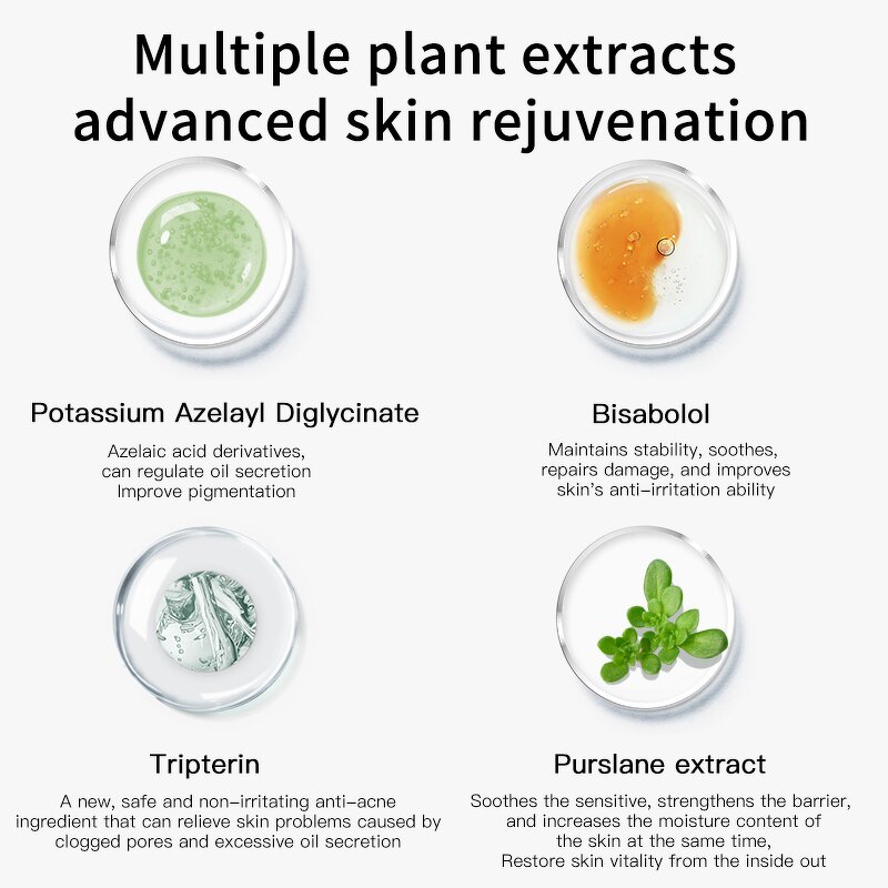 Face Toner Manufacturer - 120ML 28Days Repair Anti Acne Oil Control Hyaluronic Acid & JUYOU Private Label