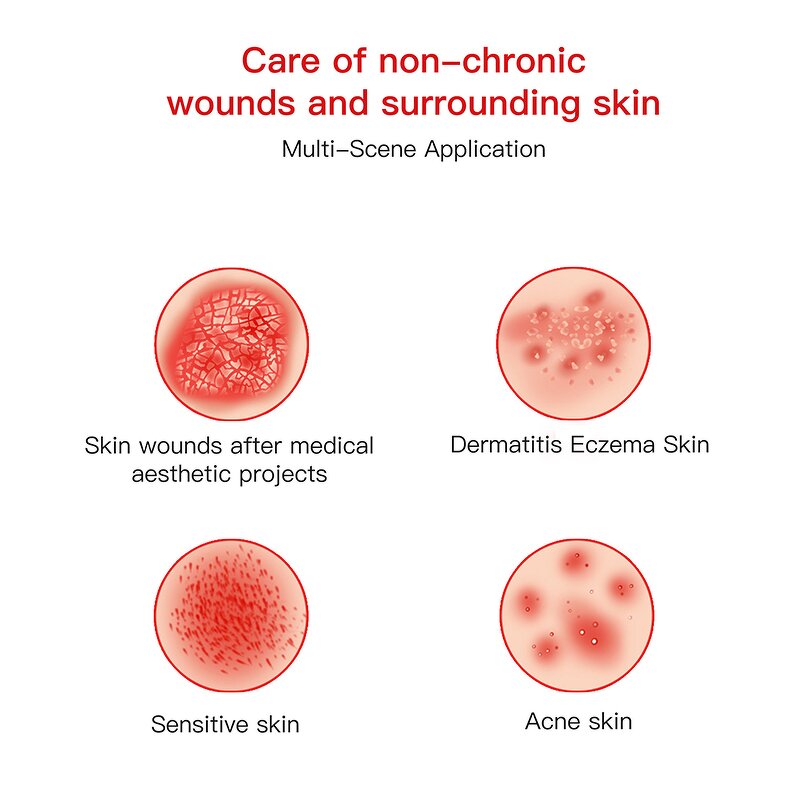 Repair Cream Manufacturer - Aseptic Trehalose Moisturizing for Damaged Skin All Types & Juyou