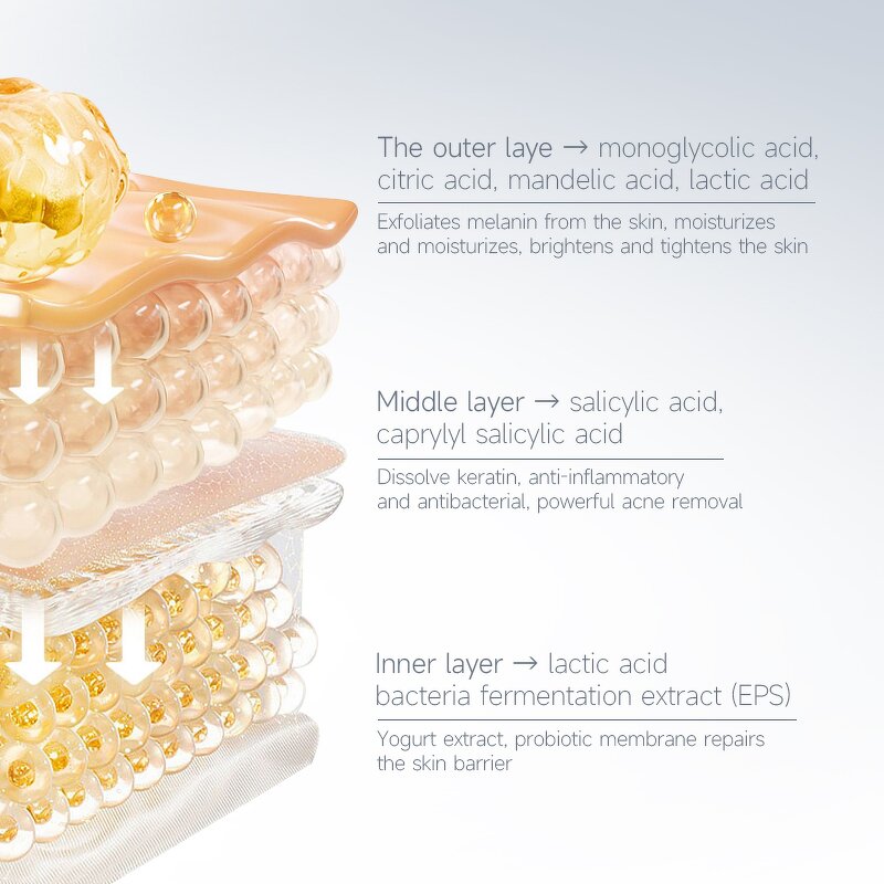 Chemical Peeling Gel Manufacturer - 35% Compound Acid for Anti Acne Pigmentation & Professional