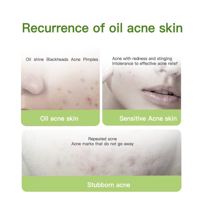 Face Mask Manufacturer - Professional Grade Anti Acne Oil Control Repair Cleaning & Juyou Wholesale