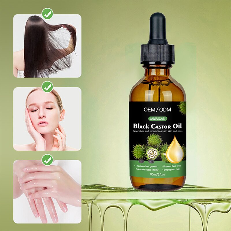 Black Castor Oil Manufacturer - OEM Anti Hair Loss Fast Growth Thickening Treatment Oil