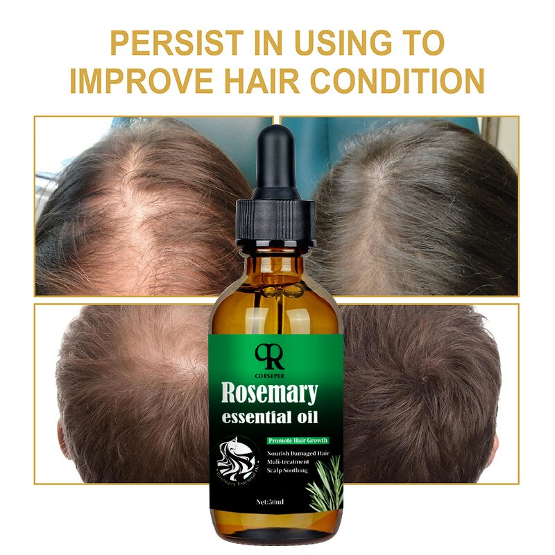 Rosemary Scalp Oil Manufacturer - Private Label 50ml Nourishing Repairing Growth Oil