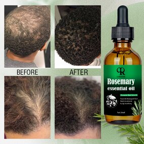 Rosemary Hair Oil Manufacturer - Custom Nourishing Tea Tree Oil Vegan Herbal Care