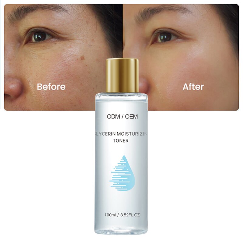 Glycerin Toner Manufacturer - OEM Organic Mineral Moisturizing Body Face Glycerin Water
