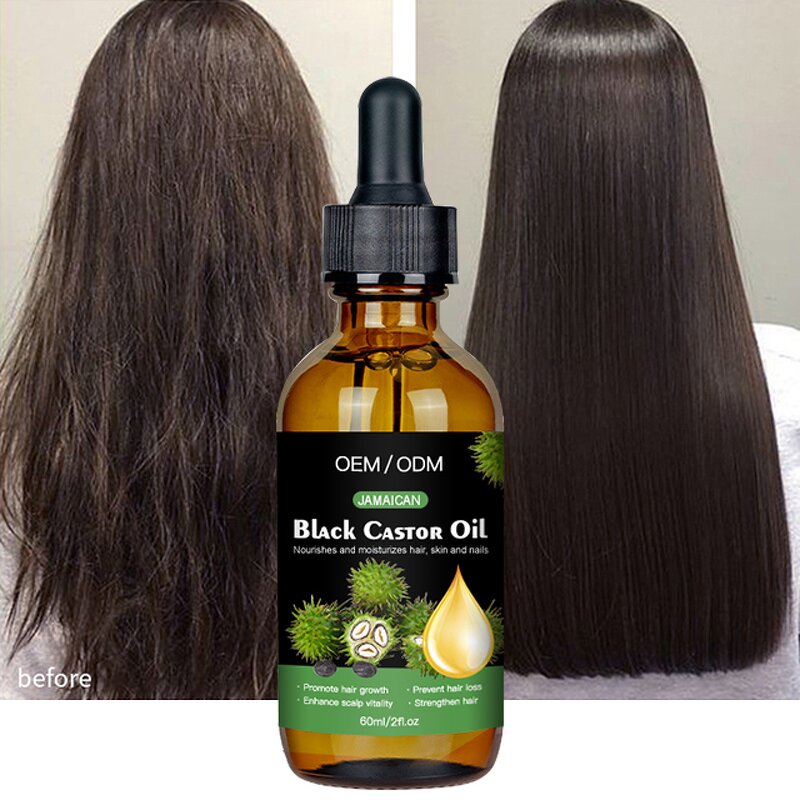 Black Castor Oil Manufacturer - OEM Herbal Anti Loss Repair Smoothing Scalp Strengthening