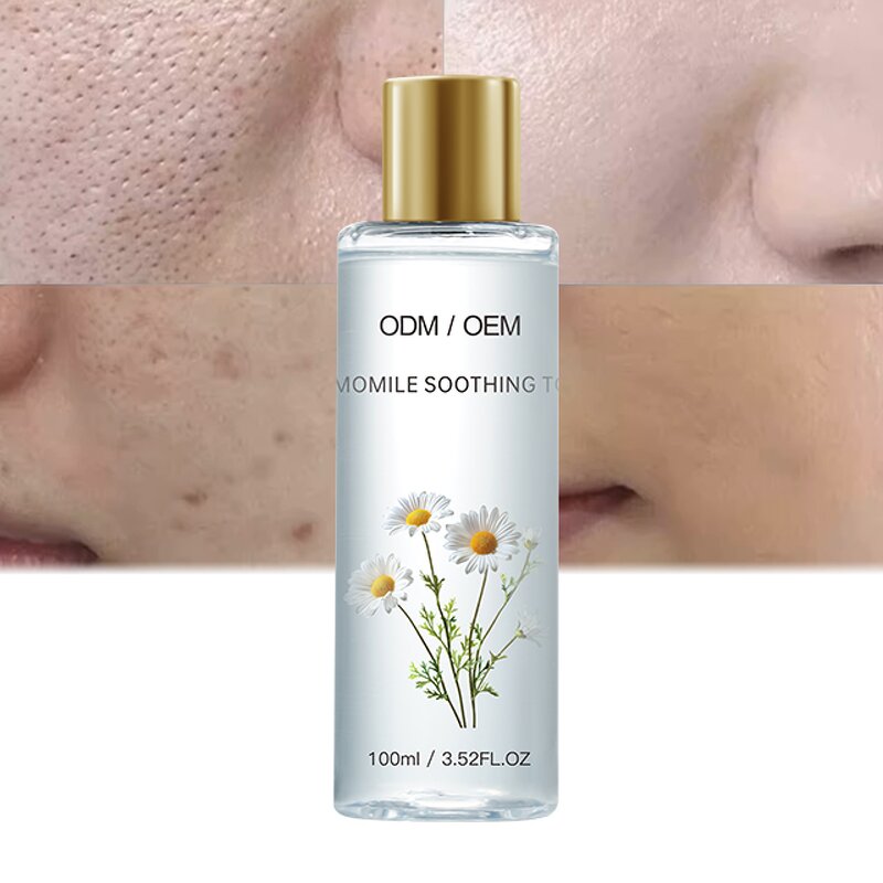 Chamomile Toner Manufacturer - OEM After-sun Repair Moisturizing Soothing Facial