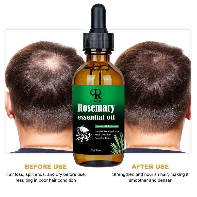 Rosemary Scalp Oil Manufacturer - Private Label 50ml Nourishing Repairing Growth Oil