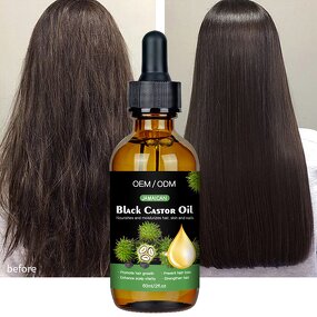 Hair Regrowth Oil Manufacturer - Top Selling Vegan Black Castor Oil Scalp Treatment OEM/ODM