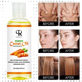 Carrot Essential Oil Manufacturer - Miracle Whitening Moisturizing Body Massage Oil
