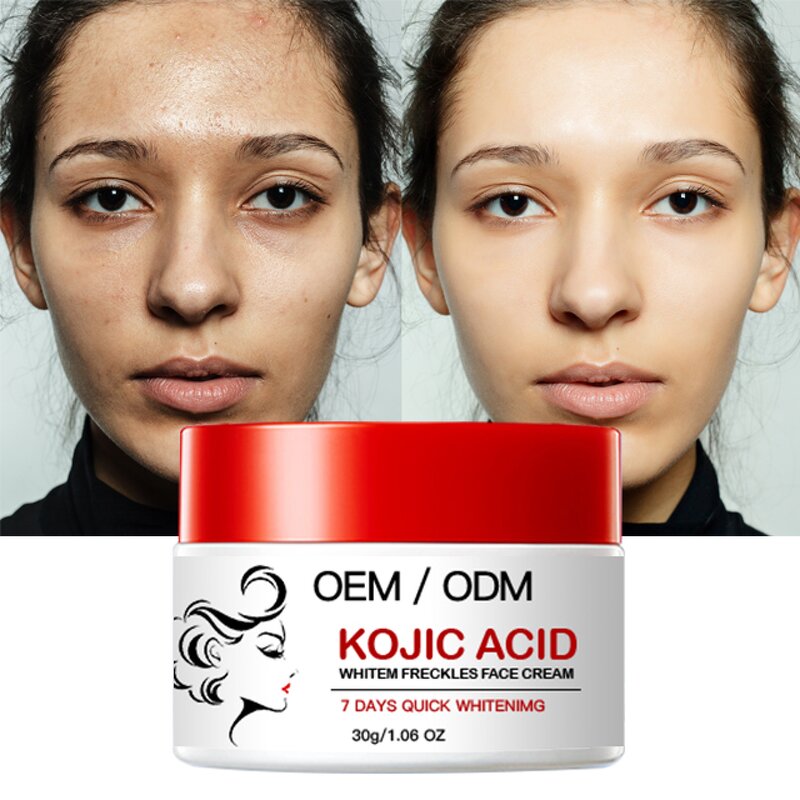 Whitening Cream Manufacturer - OEM 14 Days Vitamin C Kojic Acid Dark Spot Freckle