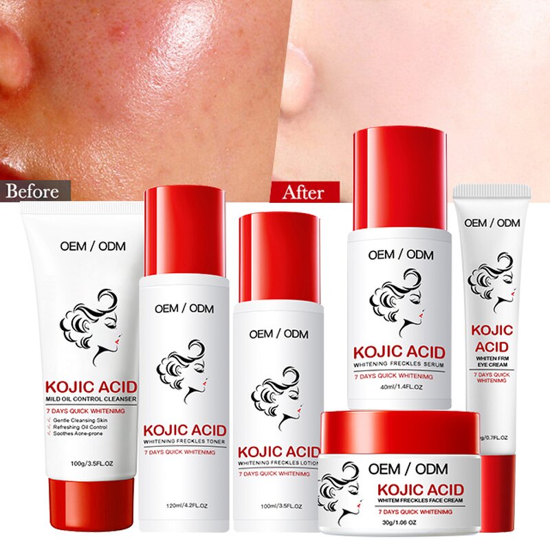 Kojic Acid Skincare Set Manufacturer - 7 Days Brightening Moisturizing Serum Cream OEM
