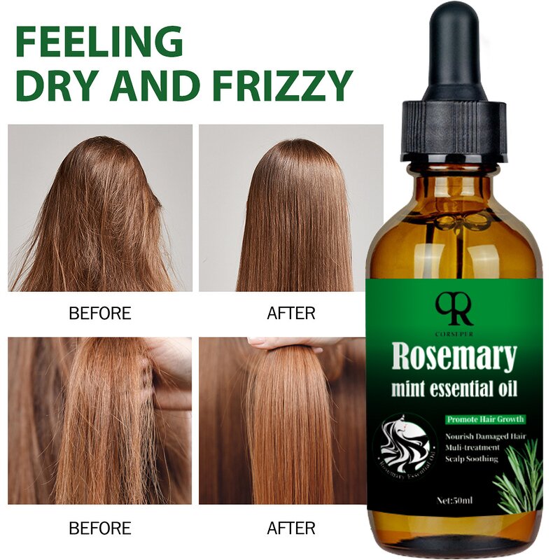 Rosemary Hair Serum Manufacturer - 100% Natural Scalp Elixir Anti Loss Growth Treatment