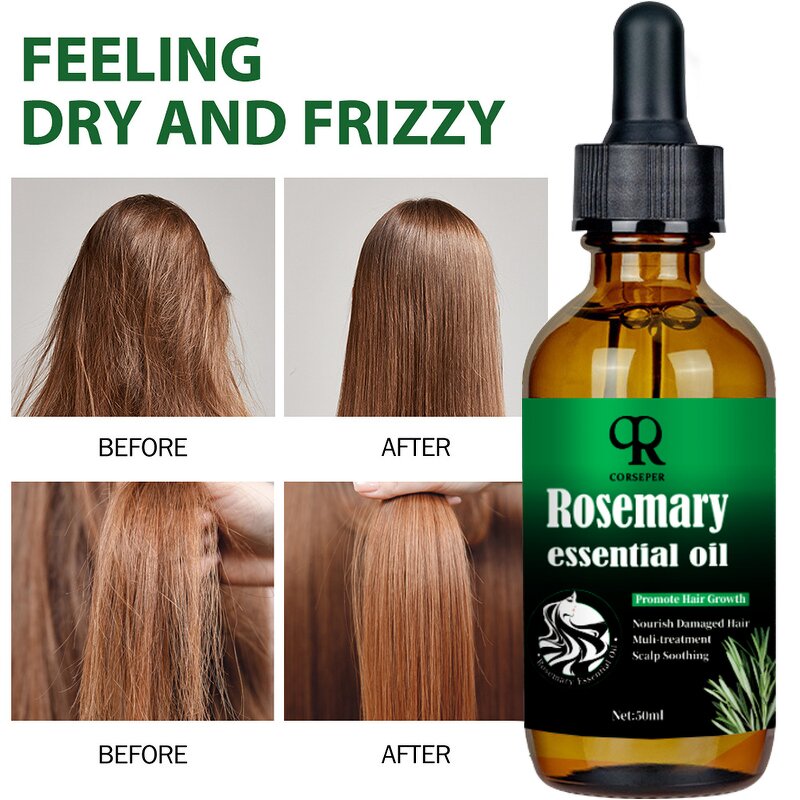 Rosemary Hair Oil Manufacturer - Private Label 100% Natural Anti Hair Loss Growth Oil