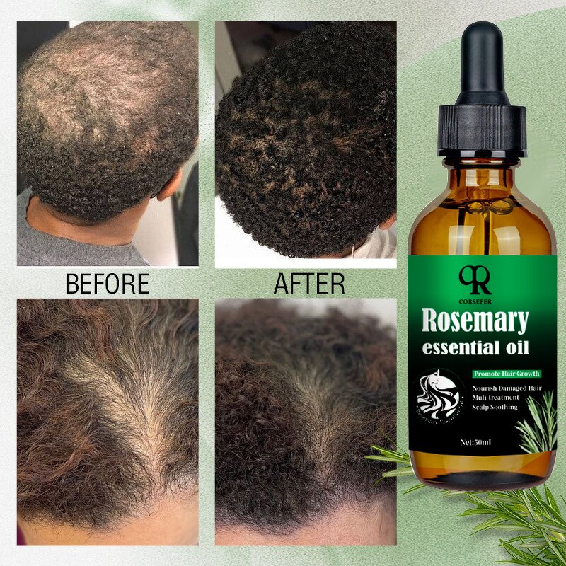 Rosemary Hair Oil Manufacturer - OEM 50ml Fast Strengthening Castor Oil All Hair Types