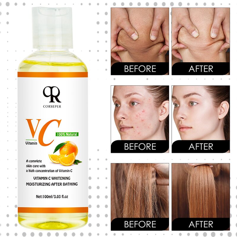 Body Massage Oil Manufacturer - 100% Organic Vitamin C Black Spots Stretch Marks