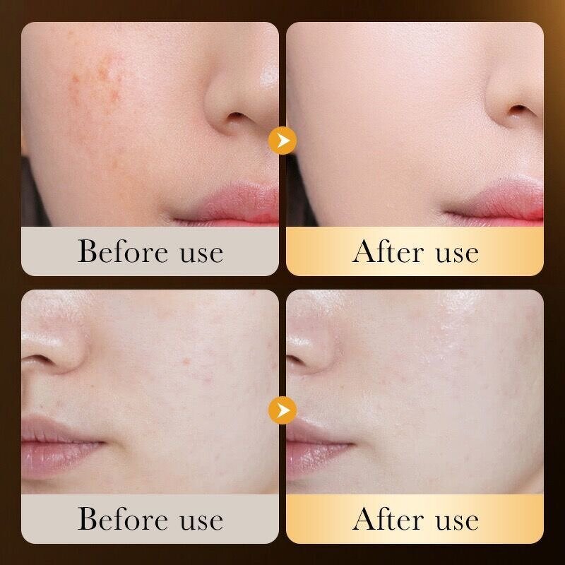 Essence Manufacturer - 24K Gold Collagen with Niacinamide Hyaluronic Acid Brightening for Nose Repairing