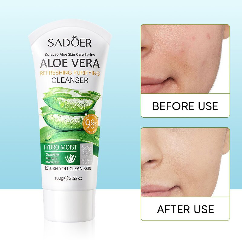 Facial Cleanser Manufacturer - Aloe Vera Gentle Deep Cleaning Hydrating Brightening Whitening Foaming & SADOER OEM ODM