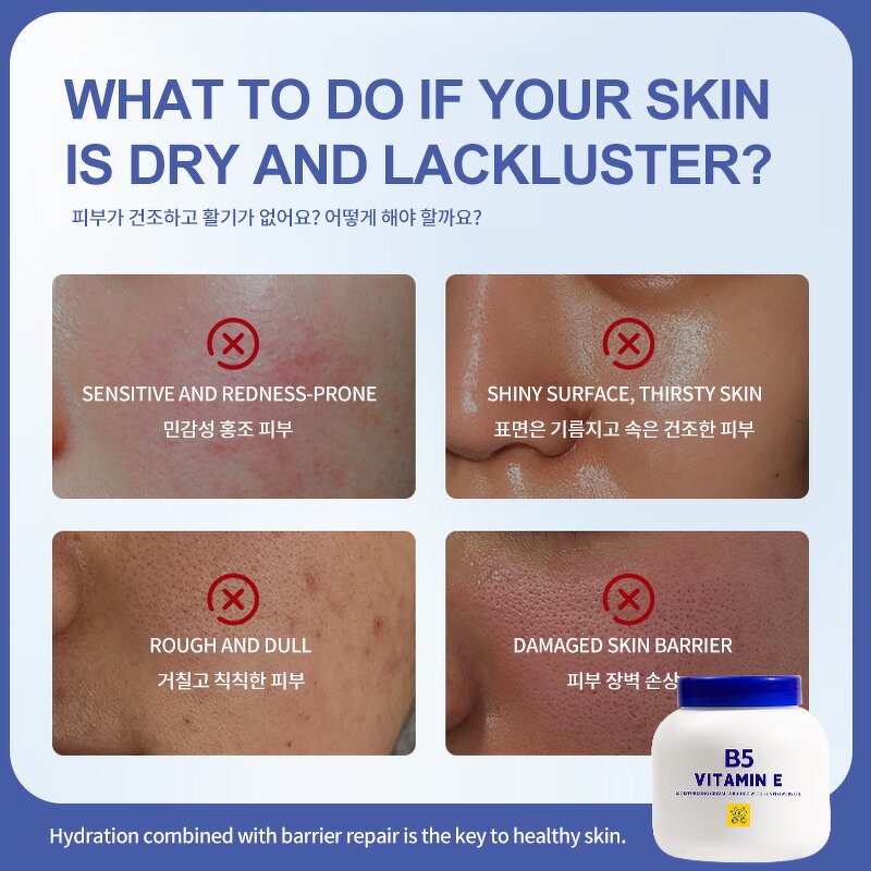 Face Cream Wholesale Supplier - Vitamin E with Sunflower Oil for Men and Women Body Lotion