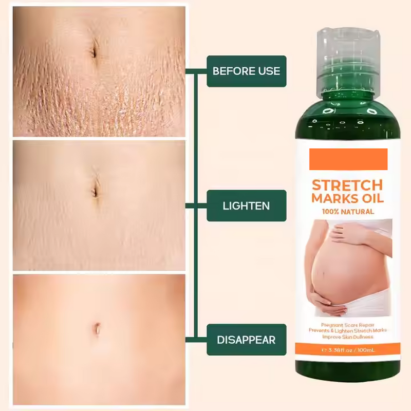 Scar Removal Cream Manufacturer - Organic Skin Revitalizer Stretch Mark Firming Postpartum Oil & Own Brand