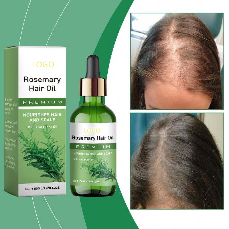 Hair Oil Manufacturer - Organic Rosemary Growth Coconut with Essential Oil for Hair-Loss Prevention